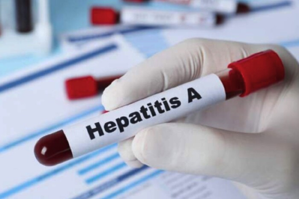 У ще одній області виявлено хвору на гепатит А